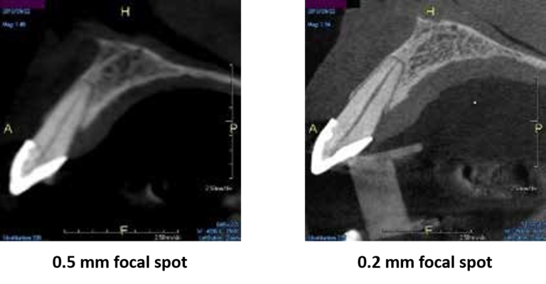 X-ERA Dental Cone Beam System